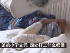 7岁男童遭烟头烫伤姑姑发声 广东7岁男童遭父亲烟头烫伤面临截肢