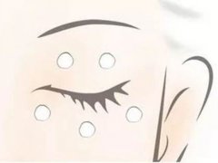 眼霜乳化方法 眼霜如何涂抹