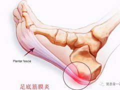脚底疼痛部位图解(脚底疼痛是怎么回事？)