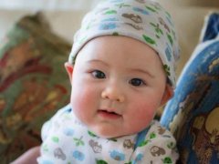 婴儿湿疹图片(记住这六步让宝宝远离湿疹！)