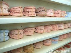 看完这篇深圳牙齿矫正攻略,避开正畸路上的坑（上篇）