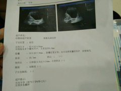 有哪位大神可以帮我ps一张怀孕报告单