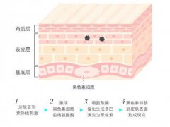 斑点是怎么形成的？英典小课堂 究其原因对症解决