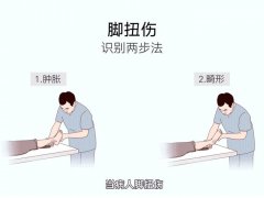 脚扭伤处理方法