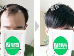 补发需要多少钱？