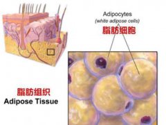 自体脂肪填充后很后悔小伙伴看过来,我的脂肪填充维持了5年呢