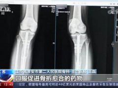 断骨增高手术严禁用于美容项目 小伙断骨增高失败面临终身残疾