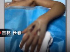 13岁男孩网购宠物蛇被咬进ICU 吉林男孩网购宠物蛇竟是竹叶青