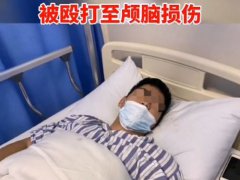 外卖小哥致电取餐被打成颅脑损伤 颅脑损伤有多严重