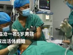 活体蚂蟥在5岁男孩体内存留1年多 男孩因喝生水体内有蚂蟥