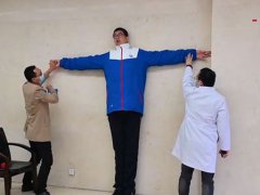 四川14岁男孩高221厘米 巨人症是怎么引起的