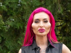 网红模特自称拥有世界最大脸颊 乌克兰网红模特整容上瘾