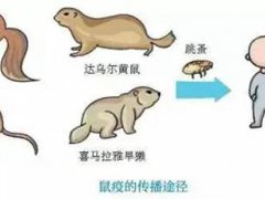 鼠疫会人传人吗 鼠疫会传染人吗 鼠疫会死人吗