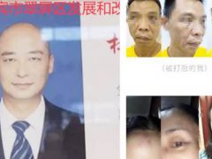 男子发文称被副局长锁在家中殴打 邻里之间发生矛盾怎么办