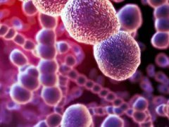 美国沙门氏菌疫情最新消息 美国沙门氏菌事件发生原因