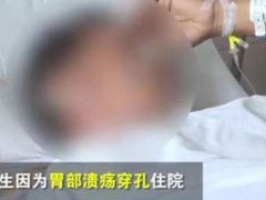 心情不好生气会气出胃穿孔吗 男子因工作调动被气出胃穿孔