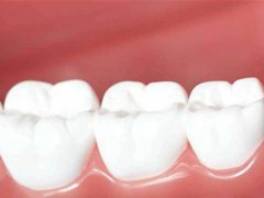 牙齿发炎怎么办 牙齿发炎吃什么消炎药 牙齿为什么发炎