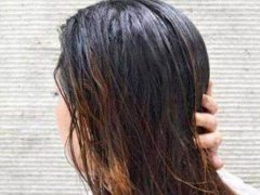 头发油腻是什么原因 头发油腻怎么解决 头发油腻怎么办
