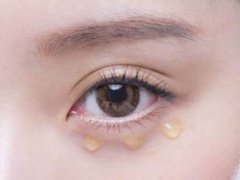 欧舒丹亮晶晶眼精华会长脂肪粒吗