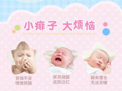 宝宝夏天用爽身粉还是身体乳好