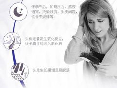 海飞丝防脱青春水真的管用吗