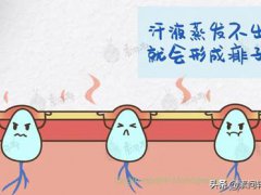 痱子怎么治(宝宝长痱子怎么办？)