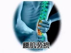 腰肌劳损治疗方法(腰肌劳损的治疗方法有哪些？)