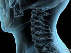脊髓型颈椎病的症状(脊髓型颈椎病有哪些表现症状？)