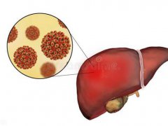 得了肝病有什么症状？(肝脏的症状表现多种多样)