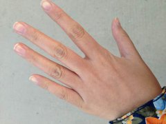 手指甲上的月牙(人指甲上为什么会有白色的月牙？)