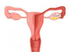 子宫卵巢保养(保护卵巢和子宫的措施)