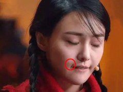 郑爽嘴角的伤疤是怎么来的(郑爽嘴角为什么有伤痕？)
