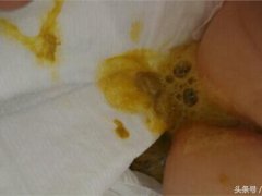 宝宝发烧腹泻(宝宝发烧腹泻的症状)