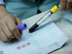 肌酸激酶偏高的原因(肌酸激酶偏高的原因和注意事项)