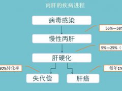 丙肝的主要症状(丙肝的症状有哪些？)