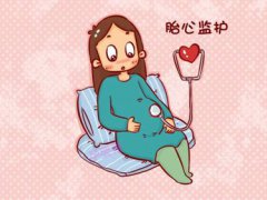 胎心监护的作用(孕期为什么要做胎心监护？)