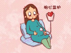 胎心监护的作用(孕期为什么要做胎心监护？)