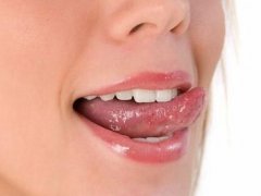 舌癌的早期症状(舌癌的早期症状有哪些)