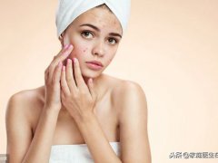 脸上痘坑怎么消除(留下痘坑？三个方法帮你淡化痘坑！)
