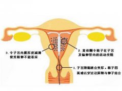 避孕环图(女性上环图解)