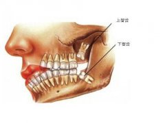智齿什么时候长(成年后都会长智齿吗)