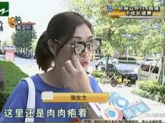 法令纹不对称(女子嫌自己法令纹太深)